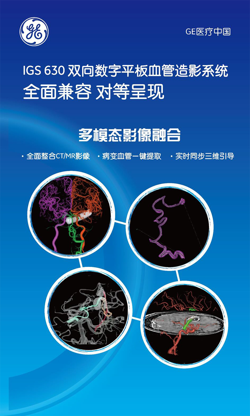 IGS630双向数字平板血管造影系统-4
