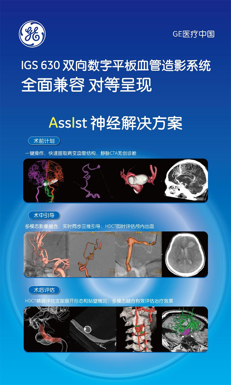 IGS630双向数字平板血管造影系统-7