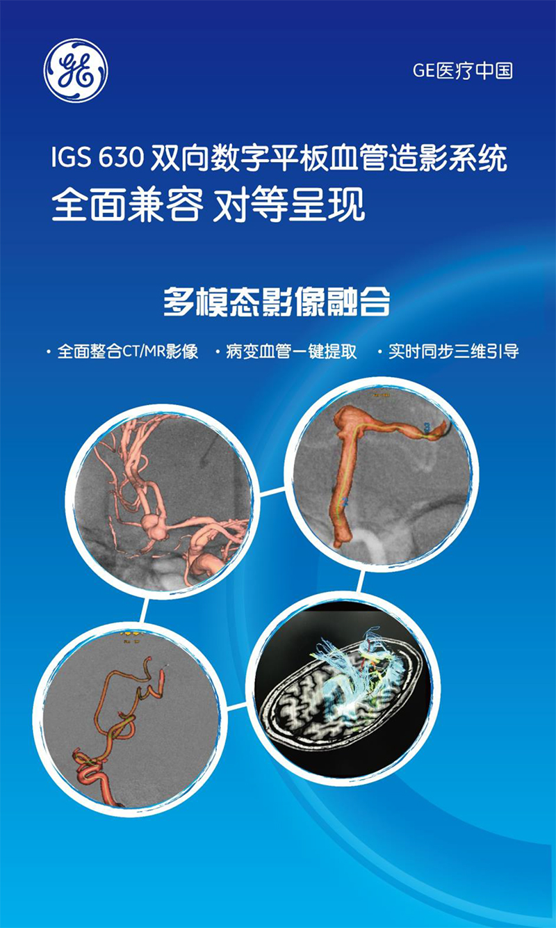 IGS630双向数字平板血管造影系统-5