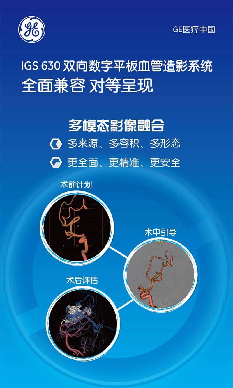 IGS630双向数字平板血管造影系统-3