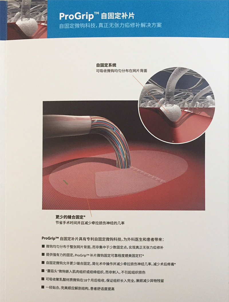 PP和TEM系列先容-3